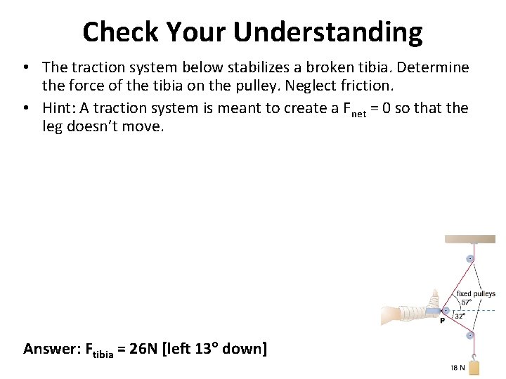Check Your Understanding • The traction system below stabilizes a broken tibia. Determine the