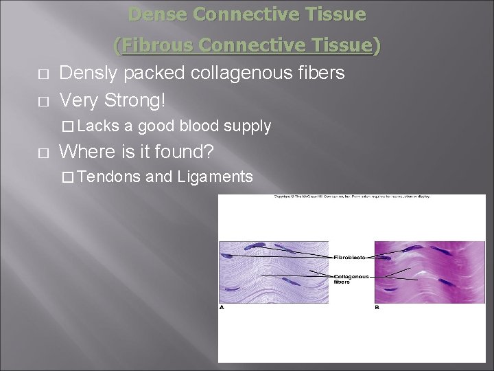 Dense Connective Tissue � � (Fibrous Connective Tissue) Densly packed collagenous fibers Very Strong!