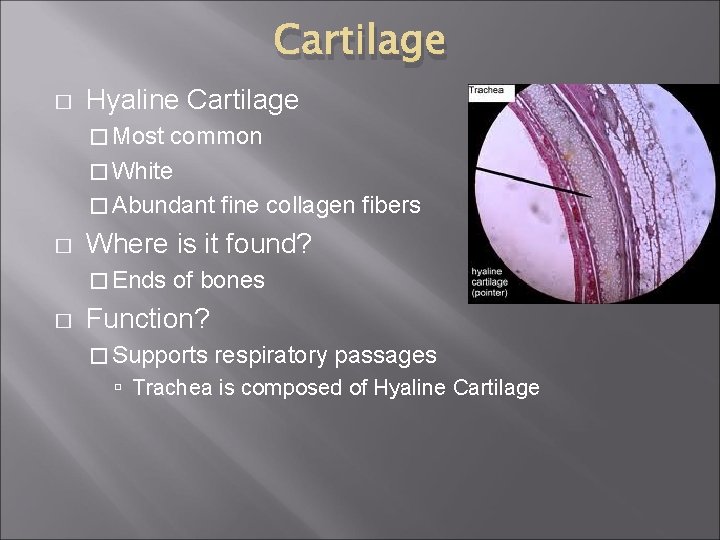 Cartilage � Hyaline Cartilage � Most common � White � Abundant fine collagen fibers