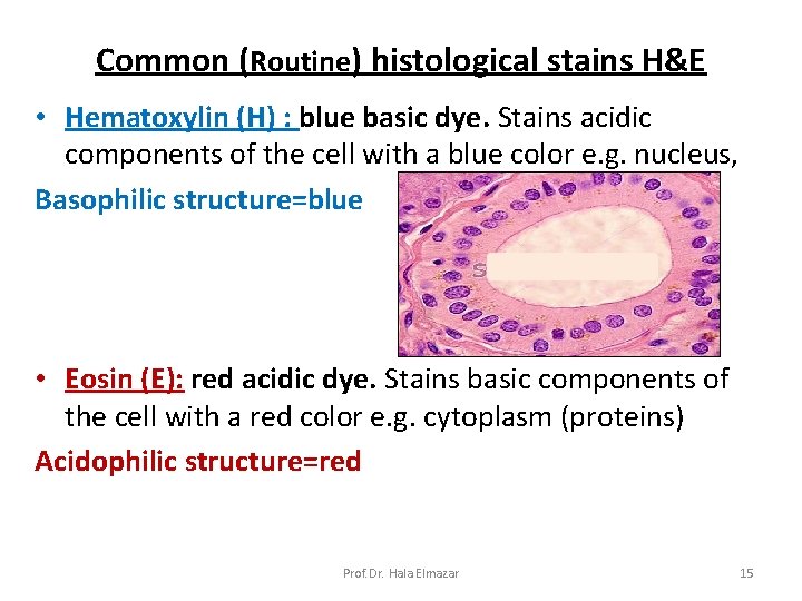 Common (Routine) histological stains H&E • Hematoxylin (H) : blue basic dye. Stains acidic