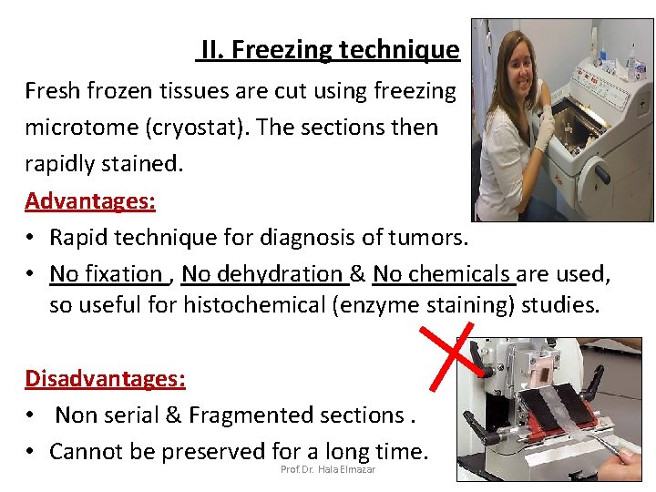 II. Freezing technique Fresh frozen tissues are cut using freezing microtome (cryostat). The sections