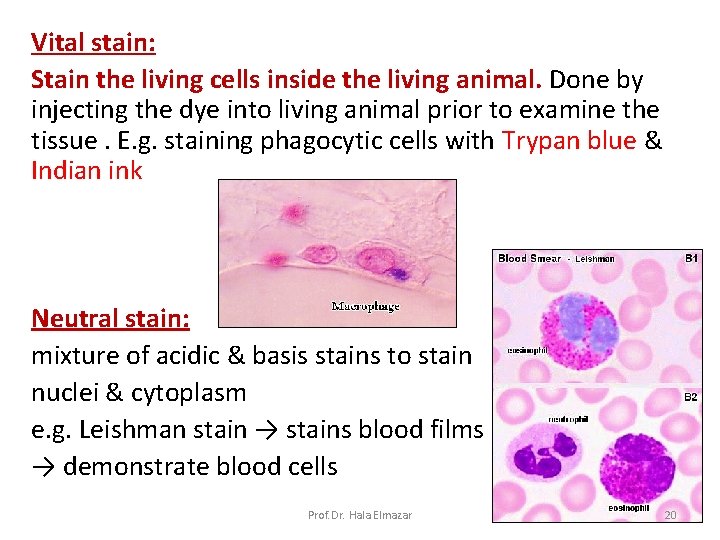 Vital stain: Stain the living cells inside the living animal. Done by injecting the