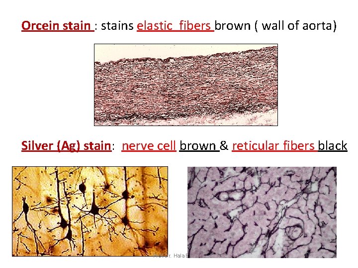 Orcein stain : stains elastic fibers brown ( wall of aorta) Silver (Ag) stain: