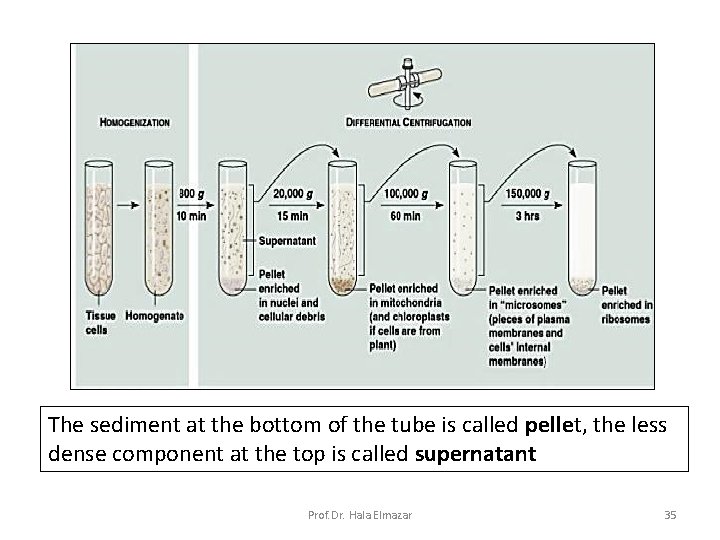 The sediment at the bottom of the tube is called pellet, the less dense