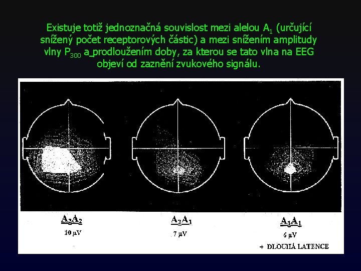 Existuje totiž jednoznačná souvislost mezi alelou A 1 (určující snížený počet receptorových částic) a Existuje totiž jednoznačná souvislost mezi alelou A 1 (určující snížený počet receptorových částic) a