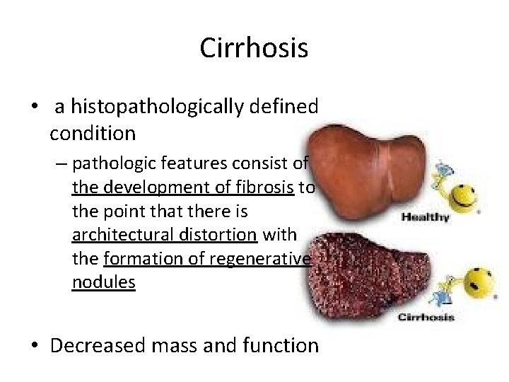 Cirrhosis • a histopathologically defined condition – pathologic features consist of the development of