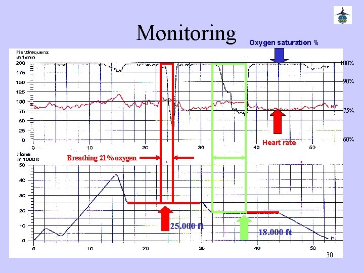 Monitoring Oxygen saturation % 100% 90% 75% 60% Heart rate Breathing 21% oxygen 25.
