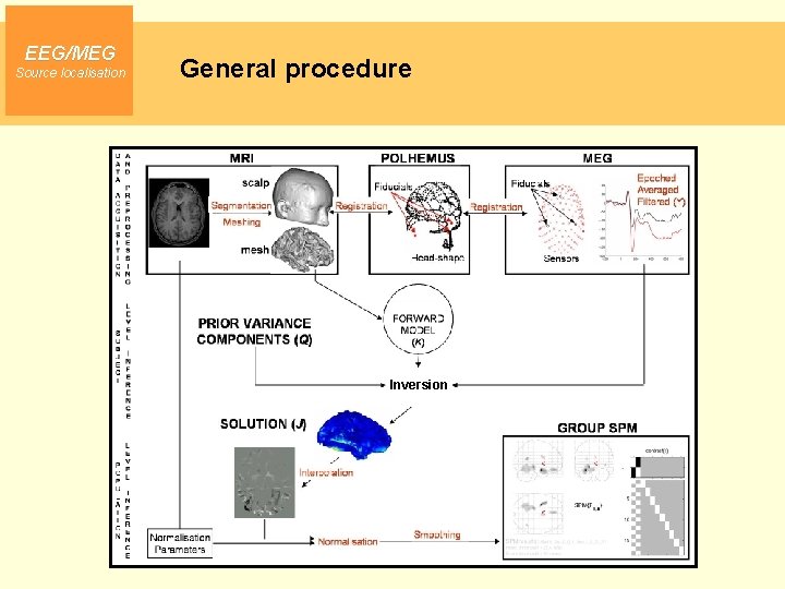 EEG/MEG Source localisation General procedure Inversion 