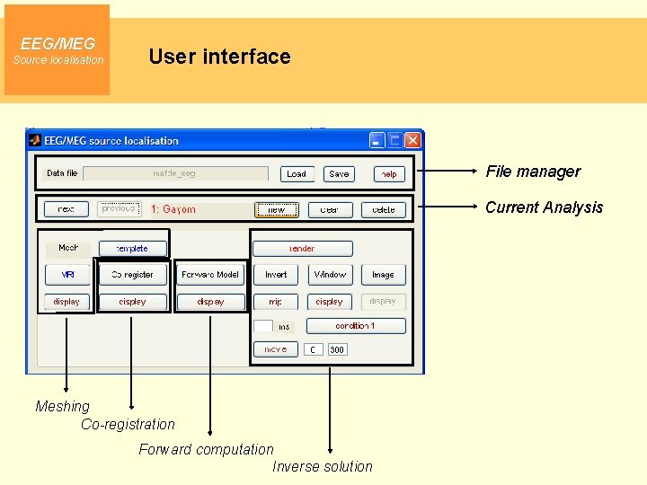 EEG/MEG Source localisation User interface File manager Current Analysis Meshing Co-registration Forward computation Inverse