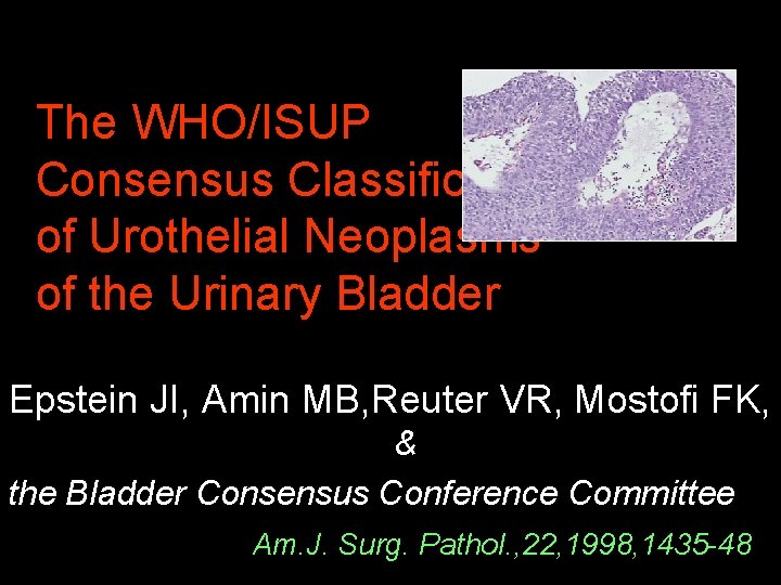 The WHO/ISUP Consensus Classification of Urothelial Neoplasms of the Urinary Bladder Epstein JI, Amin