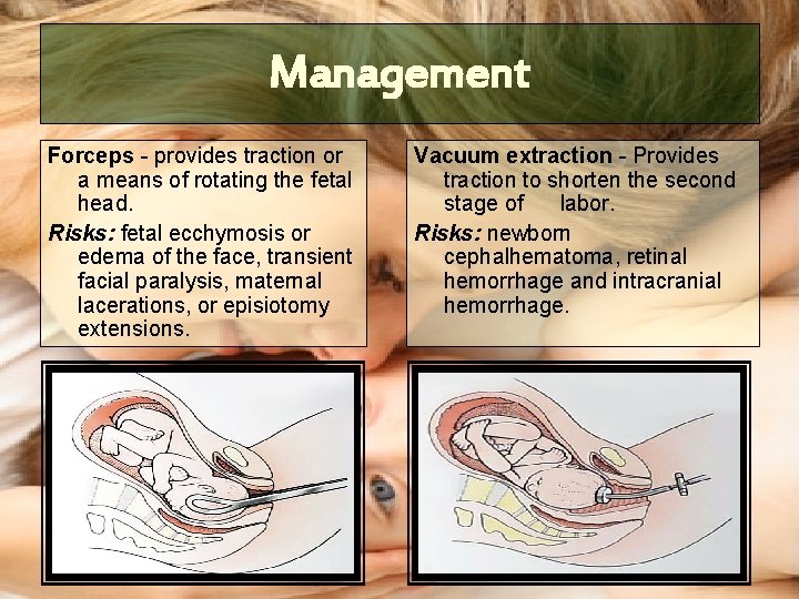 Management Forceps - provides traction or a means of rotating the fetal head. Risks: Management Forceps - provides traction or a means of rotating the fetal head. Risks: