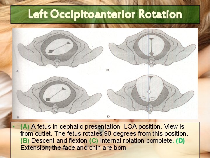 Left Occipitoanterior Rotation • (A) A fetus in cephalic presentation, LOA position. View is Left Occipitoanterior Rotation • (A) A fetus in cephalic presentation, LOA position. View is