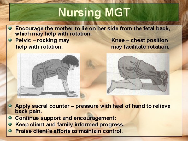 Nursing MGT Encourage the mother to lie on her side from the fetal back, Nursing MGT Encourage the mother to lie on her side from the fetal back,