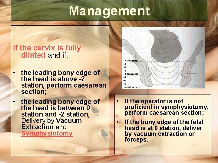 Management If the cervix is fully dilated and if: • the leading bony edge Management If the cervix is fully dilated and if: • the leading bony edge