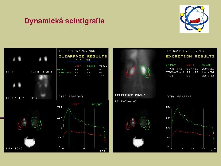 Dynamická scintigrafia 