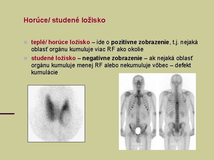 Horúce/ studené ložisko teplé/ horúce ložisko – ide o pozitívne zobrazenie, t. j. nejaká