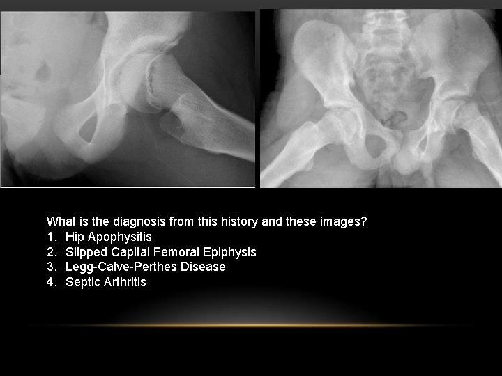 What is the diagnosis from this history and these images? 1. Hip Apophysitis 2.