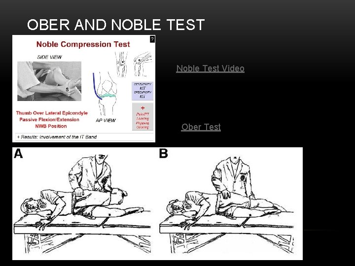 OBER AND NOBLE TEST Noble Test Video Ober Test 