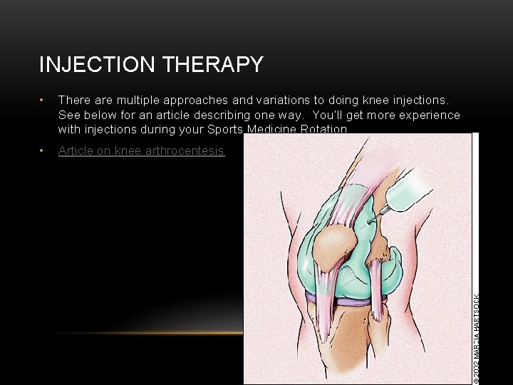 INJECTION THERAPY • There are multiple approaches and variations to doing knee injections. See