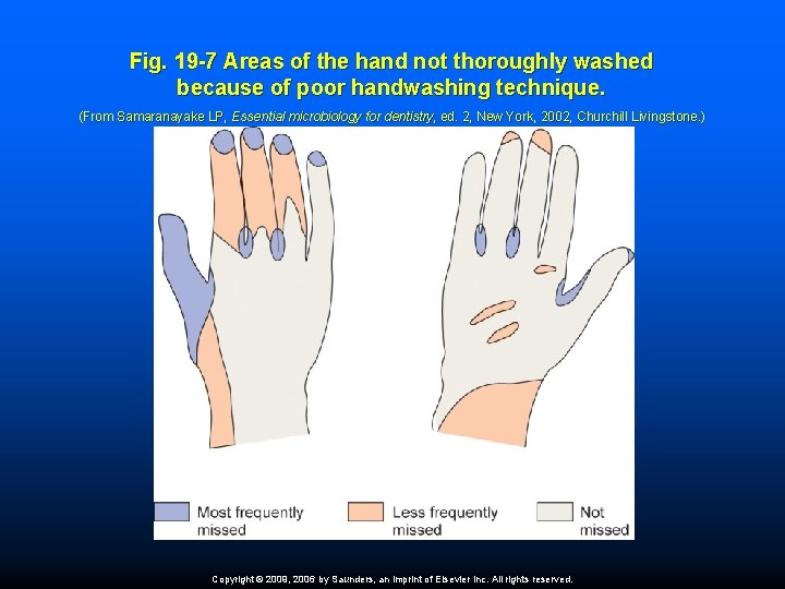 Fig. 19 -7 Areas of the hand not thoroughly washed because of poor handwashing