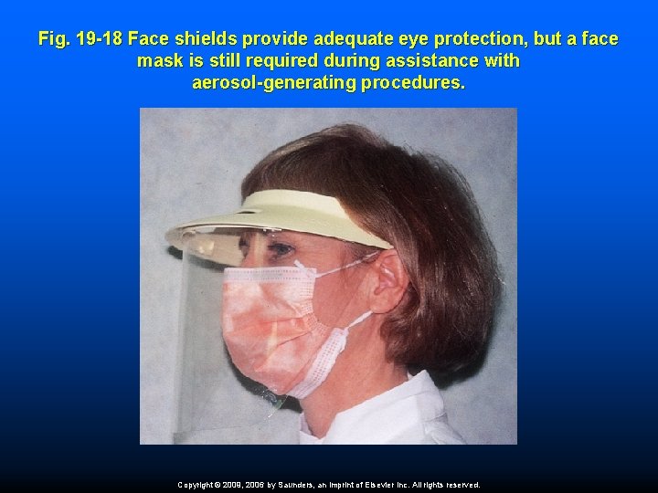 Fig. 19 -18 Face shields provide adequate eye protection, but a face mask is