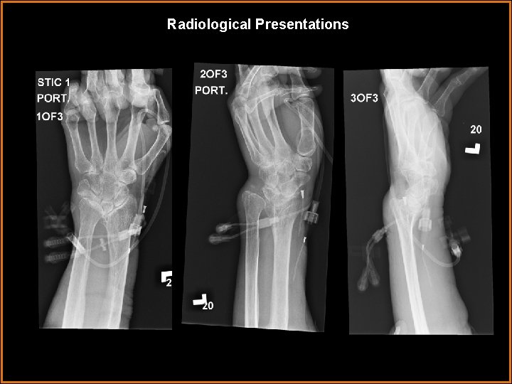 Radiological Presentations 