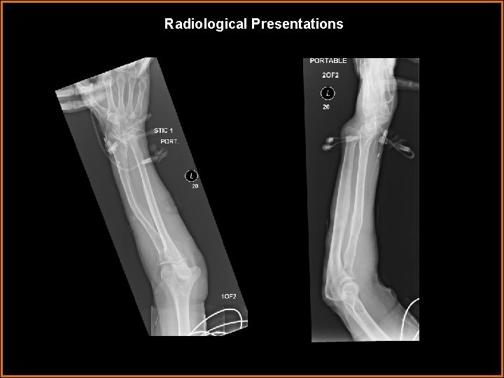 Radiological Presentations 