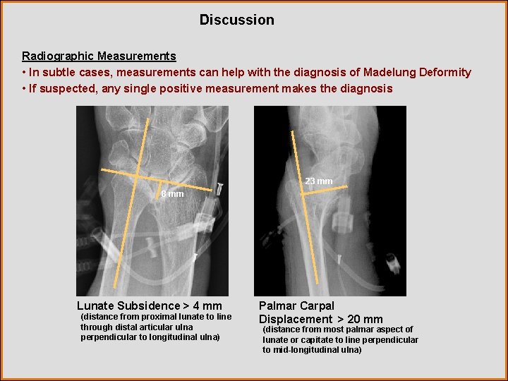 Discussion Radiographic Measurements • In subtle cases, measurements can help with the diagnosis of