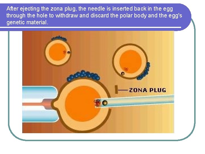 After ejecting the zona plug, the needle is inserted back in the egg through