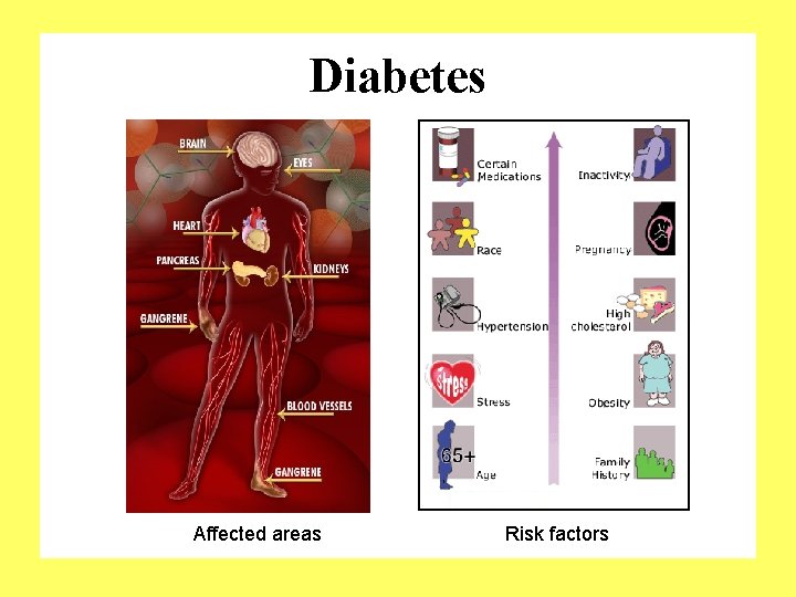 Diabetes Affected areas Risk factors 