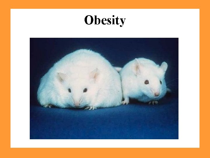Obesity 