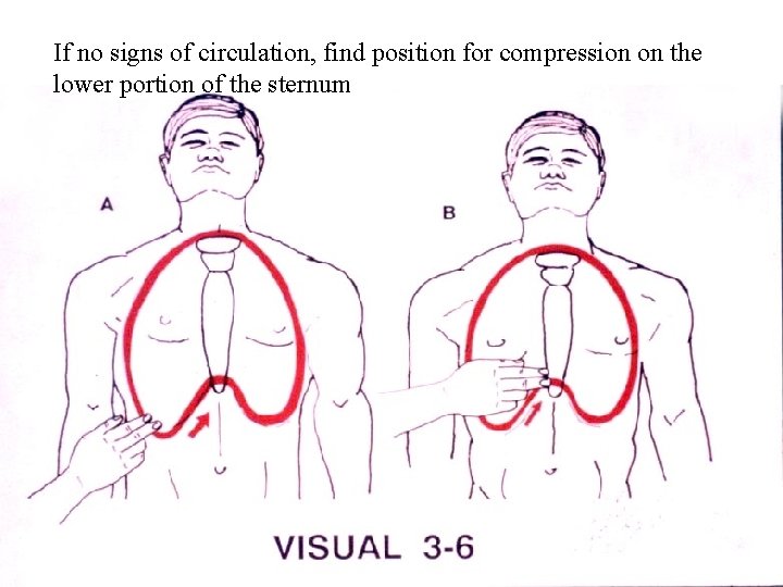 If no signs of circulation, find position for compression on the lower portion of
