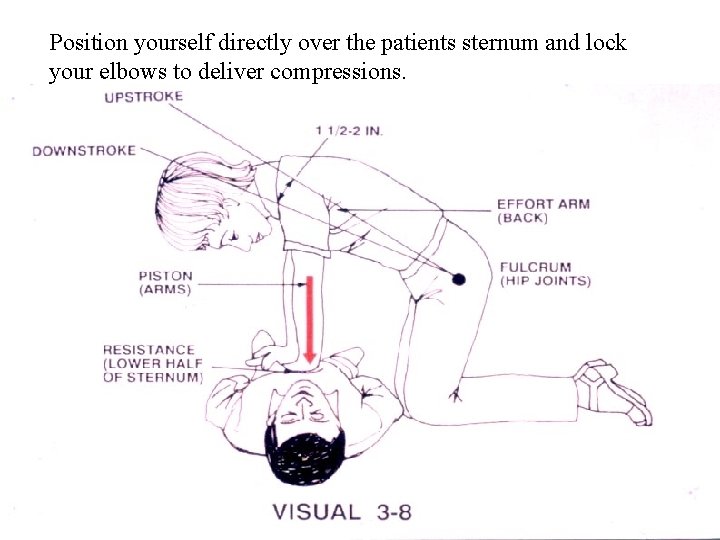Position yourself directly over the patients sternum and lock your elbows to deliver compressions.