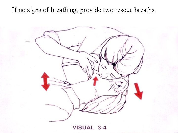 If no signs of breathing, provide two rescue breaths. 