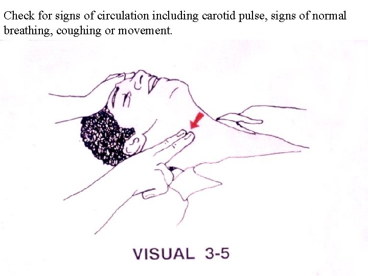 Check for signs of circulation including carotid pulse, signs of normal breathing, coughing or