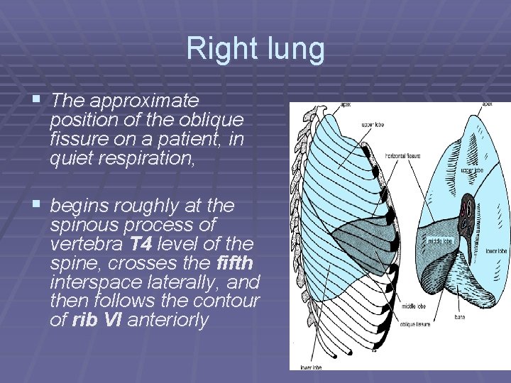 Right lung § The approximate position of the oblique fissure on a patient, in
