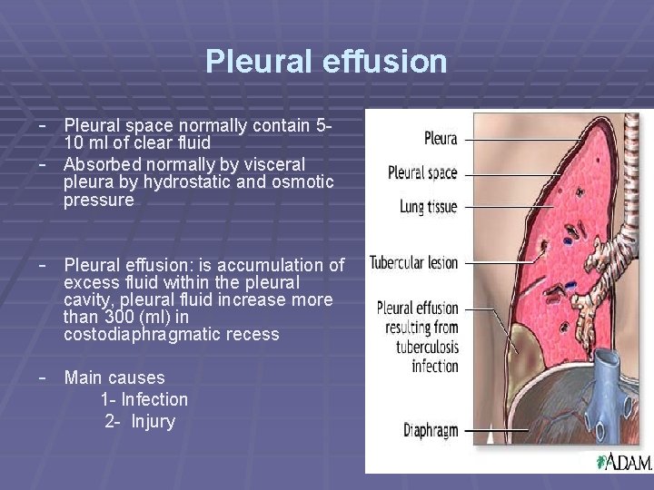 Pleural effusion - Pleural space normally contain 5 - 10 ml of clear fluid