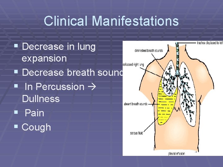 Clinical Manifestations § Decrease in lung expansion § Decrease breath sound § In Percussion