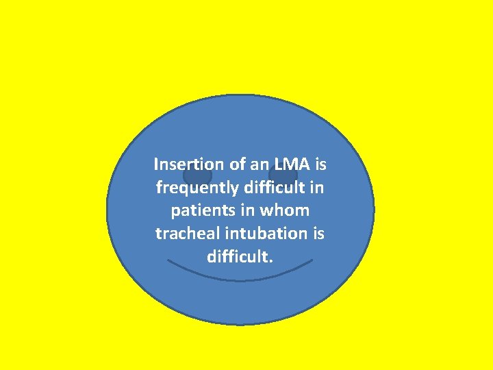 Insertion of an LMA is frequently difficult in patients in whom tracheal intubation is