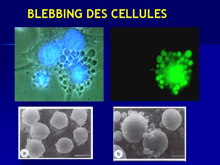 BLEBBING DES CELLULES 