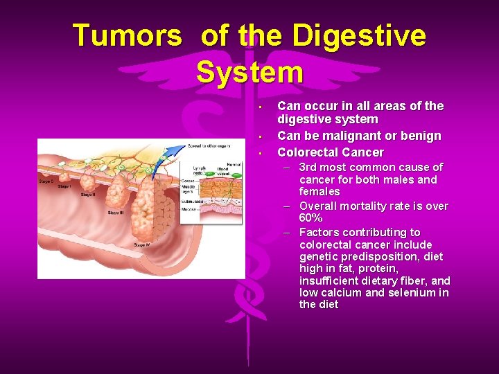 Tumors of the Digestive System • • • Can occur in all areas of
