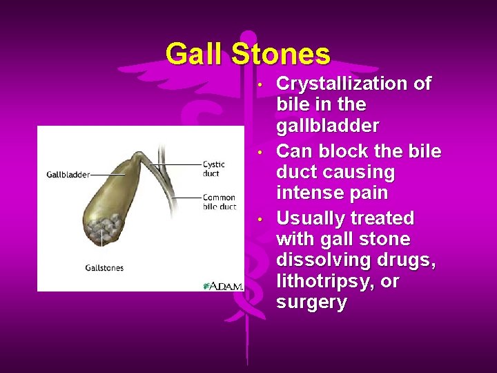 Gall Stones • • • Crystallization of bile in the gallbladder Can block the