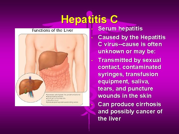 Hepatitis C • • Serum hepatitis Caused by the Hepatitis C virus--cause is often