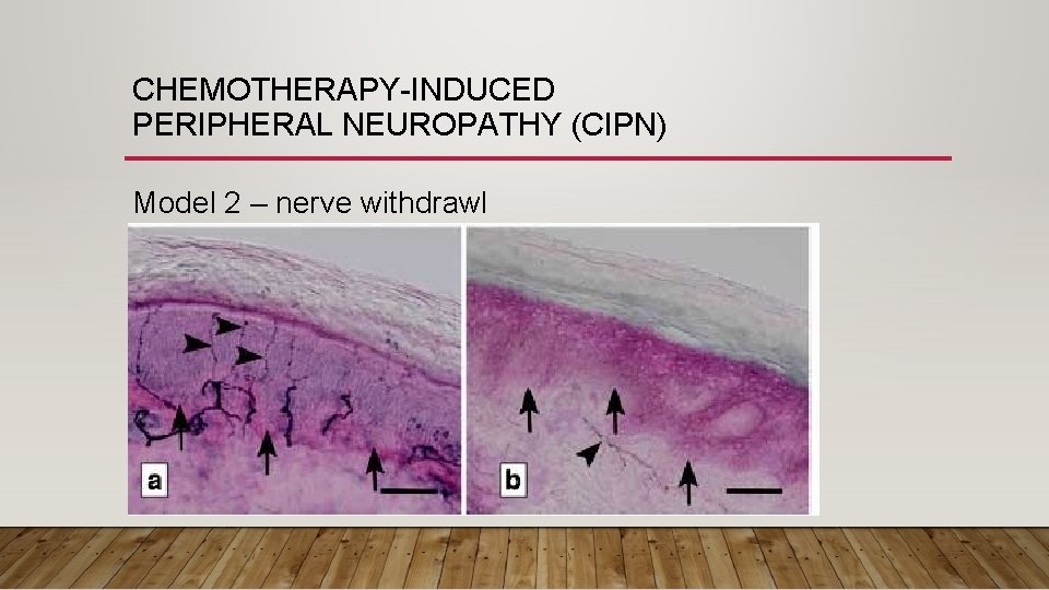 CHEMOTHERAPY-INDUCED PERIPHERAL NEUROPATHY (CIPN) Model 2 – nerve withdrawl 