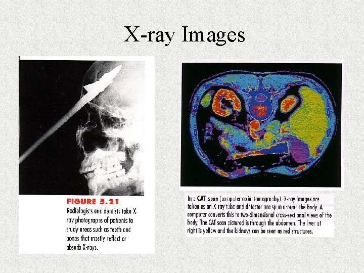 X-ray Images X-ray Images