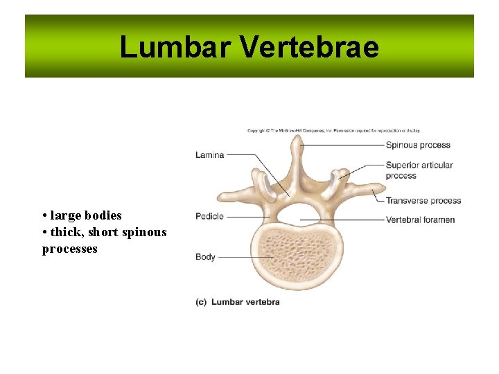 Lumbar Vertebrae • large bodies • thick, short spinous processes 