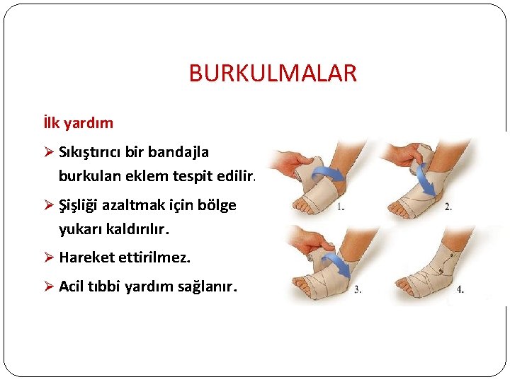 BURKULMALAR İlk yardım Ø Sıkıştırıcı bir bandajla burkulan eklem tespit edilir. Ø Şişliği azaltmak