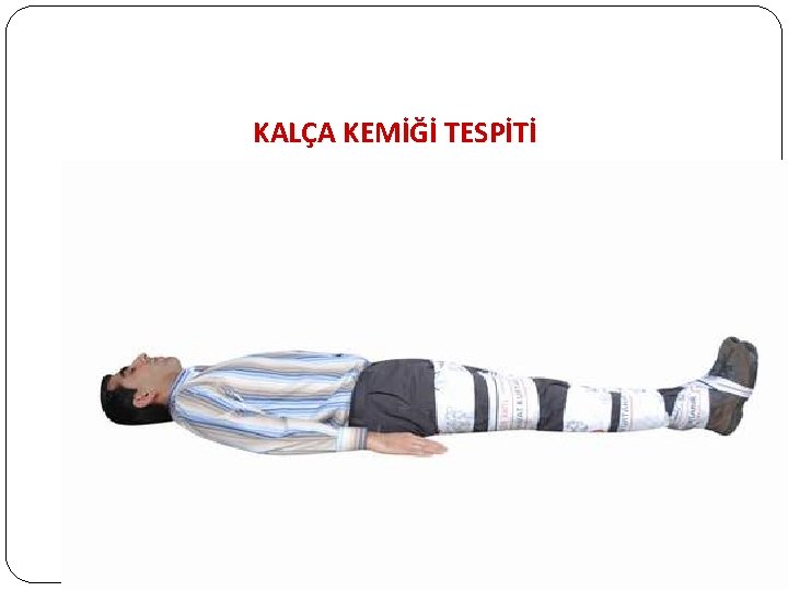 KALÇA KEMİĞİ TESPİTİ 