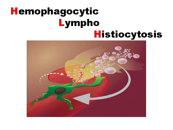 Hemophagocytic Lympho Histiocytosis 