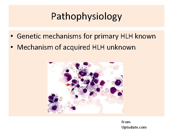 Pathophysiology • Genetic mechanisms for primary HLH known • Mechanism of acquired HLH unknown